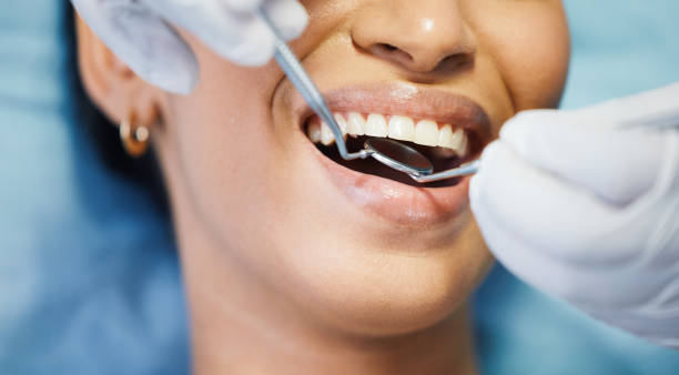 Best Same-Day Emergency Dental Services in South Houston, TX